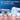 Oral-B iO Series 2 Rechargeable Electric Powered Toothbrush Starter Kit, Pure White with 2 Brush Heads - Automatic Pressure Sensor to Protect Gums - 3 Modes - 2 Min Timer